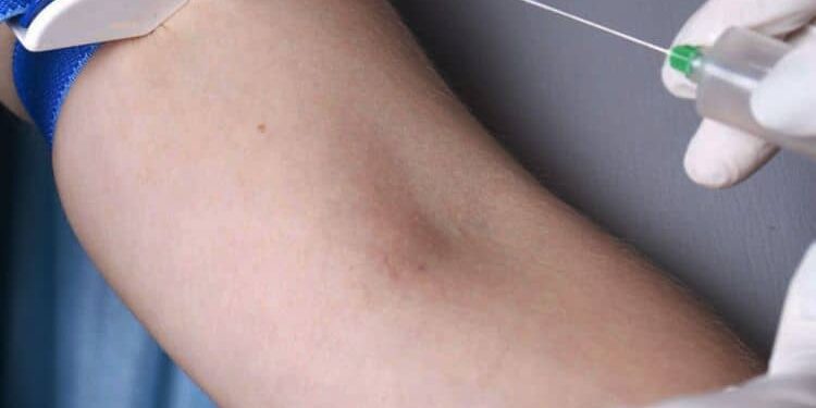 What you need to do to get a medical fitness test in the UAE?